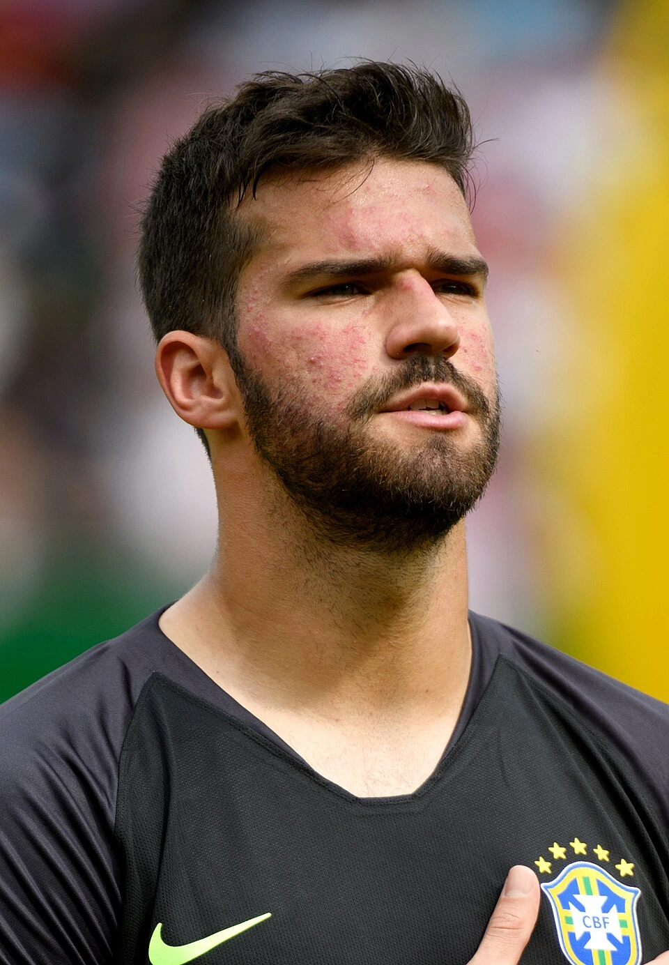 Alisson Becker Goalkeeper Net Worth Estimate and Earnings Breakdown